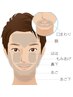 【脱毛】髭パーツ脱毛　～お好きな部位を2箇所選べます～