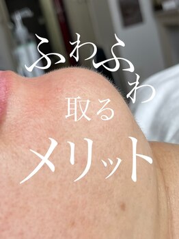 アイラッシュサロン ウェリナ 名古屋(Welina)/産毛処理しませんか?