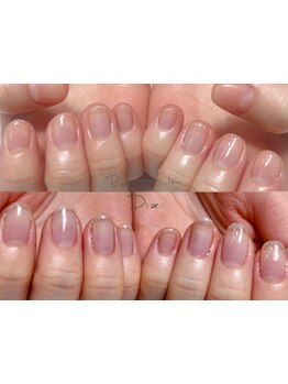 爪の悩みを解消できる（ケア含む）