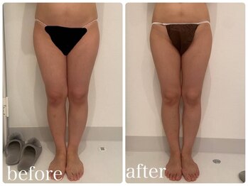 美人バスト 本厚木店/【痩身】症例☆