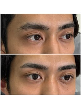 スムースラボ(Smooth LABO)/1回目より2回目。まずは1回目