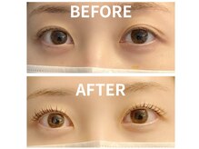 アイカール(I.curl)