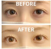 アイカール(I.curl)