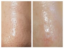 ウェリナベル(WelinaBelle)の雰囲気（韓国美容で注目のララピール毛穴・ニキビケア・シミシワケア）