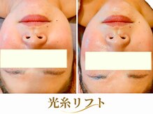 ボディメイキング キキ(Bodymaking KIKI)の雰囲気（毛穴ケア・幹細胞導入・光糸リフトなどエイジングケアに特化）