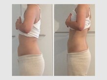 カロン 銀座(Kalon)/【腸もみ60分】10回結果！