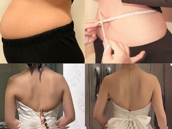 ヨサパーク ビウィズ(YOSAPARK 美 with)の写真/本気痩身！スッキリサイズダウン！余分な脂肪を燃焼・分解を促す！リバウンドしづらいボディへ！