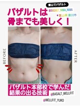 ニワ(Niwa)/バザルトバスト