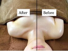 下垂のケアにも強いアンシャンテ！