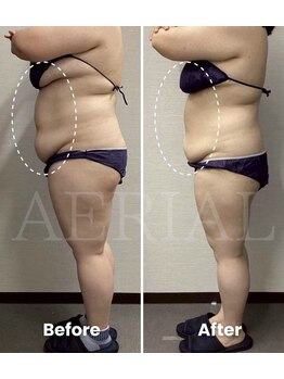 エアリアル 大川店/お腹のお肉エアリアルにお任せ!