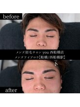 ユー 西船橋店(you)/ビフォーアフターお写真