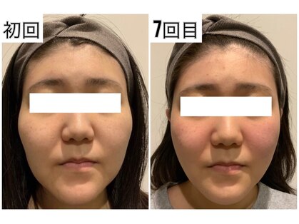 大通駅の小顔矯正 造顔がおすすめのサロン 口コミ人気ランキング ホットペッパービューティー