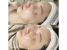 サーデ(saade)/クリスティーナトリートメント