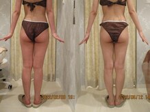 プロラボスパ 池袋東口店/20代後半　症例写真