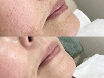 ボン セジュール(Bon sejour)/フェイシャルワックス