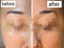 マハロ(Mahalo.N)/肌ケア