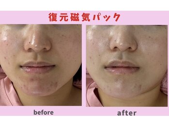 サロン ほほえむ(Fofo-m)/