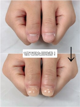サロン ド コロレ/【深爪】自爪のような仕上がり♪