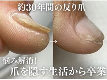 アーク(arc)の雰囲気(お爪は変化します♪)