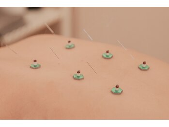 メグリ バイ テトテ(megri by TetoTe)/国家資格保有者による本格施術