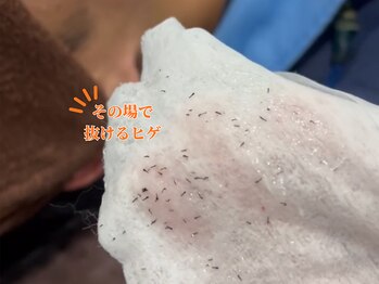 ボス 津店(BOSS)の写真/【メンズの脱毛は当たり前の時代!/都度払いOK】ヒゲ脱毛で清潔感UP♪お顔のお手入れも楽になる◎