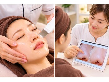 マナ(mana)の写真/【毛穴改善口コミ4.8】【毛穴集中ケア】まずは3ヶ月！月1回のメンテナンスを目指す毛穴専門店