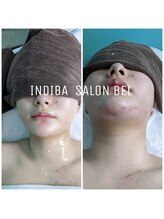 ベル(BEL)/輪郭3点DTケア