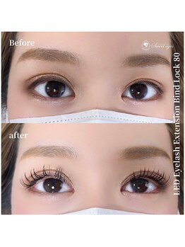 スウィートアイズ(Sweet eyes)/LEDバインドロック80束