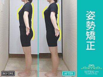美骨矯正 ステキプロ(SUTEKI pro)/反り腰・巻肩・疲労回復