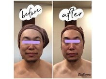 レナンセラ バイ カトレアグループ(Renanthera by カトレアGroup)/石膏パックで小顔♪