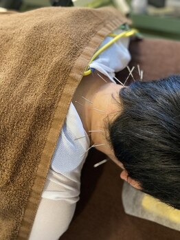 S鍼灸整骨院の写真/首・肩コリでお悩みの方へ！鍼灸で筋肉のこりを緩和し、血液の流れを促進◎体の芯からしっかりほぐします☆