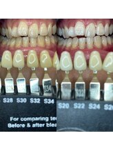 トウキョウスワーズ 池袋店(TOKYO SWRS)/#ホワイトニング #池袋 #渋谷