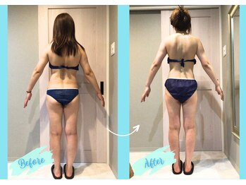 千歳の女神 三河安城店/【施術風景】Before/After