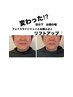 ～松田専用～フェイシャル＋デコルテ＋頭、首～手まで　70分 [女性限定]