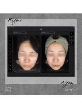 ゴーマルイチ(501)/