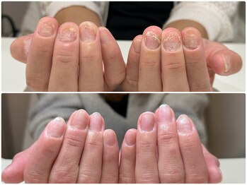 ジョワイユ(JOYEUX)/自爪育成