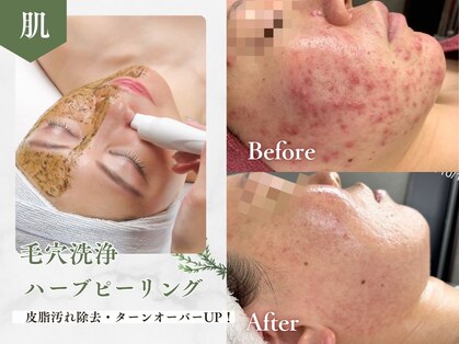 レヴィー(Revie)の写真