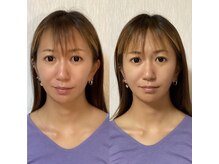 リベルテエイト(Liberte8..)/