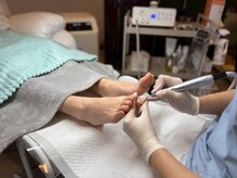 ドクターネイル爪革命 岐阜店/うおの目ケア