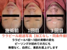 パルテール/大人気ララピール過程