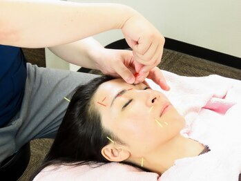 アキュピタル(acupital)の写真/筋肉と血流にアプローチする美容鍼で肌悩みを体の内側から改善◎鍼が初めての方も是非一度ご相談ください！