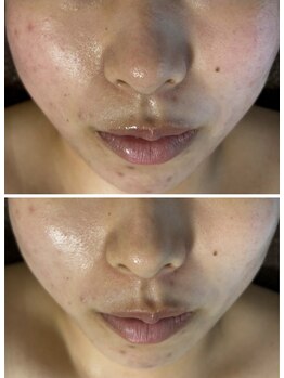 マリエンドリー/