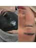 【7/6～7/11限定】美眉Wax+小鼻黒ずみ除去Wax+水光パック