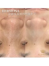 トータルエステティック ビューティスト 足利店(Total Easthetic Beautist)/