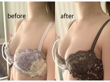 ブレスト 新宿本店(Breast)/《6回目》20代（バストアップ）