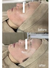 ミーミドットアイ(Mi-mi.i)/やみつき艶肌WAX