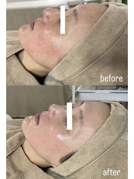 ミーミドットアイ(Mi-mi.i)/やみつき艶肌WAX