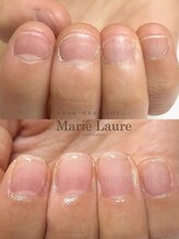 マリーロール 梅田店(Marie Laure)/深爪矯正/自爪育成/自爪風