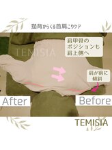 テミシア(TEMISIA)/猫背巻き肩をしっかりケア