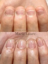 マリーロール 梅田店(Marie Laure)/深爪矯正/自爪育成/自爪風